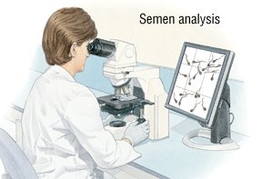Если анализ спермы полностью нормален, дальнейшая оценка редко требуется